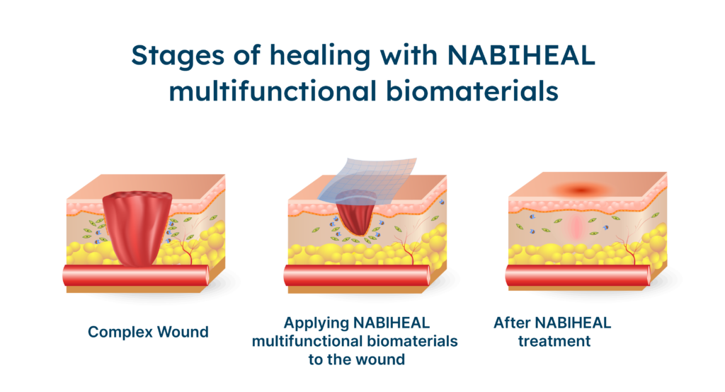 Stages of healing with NABIHEAL multifunctional biomaterials